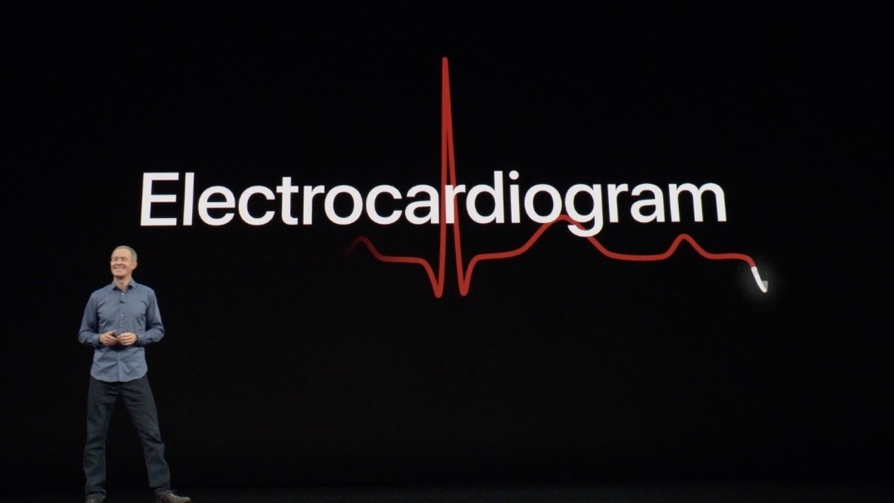 watchOS 5.1.2 habilitará el ECG de los Apple Watch Series 4